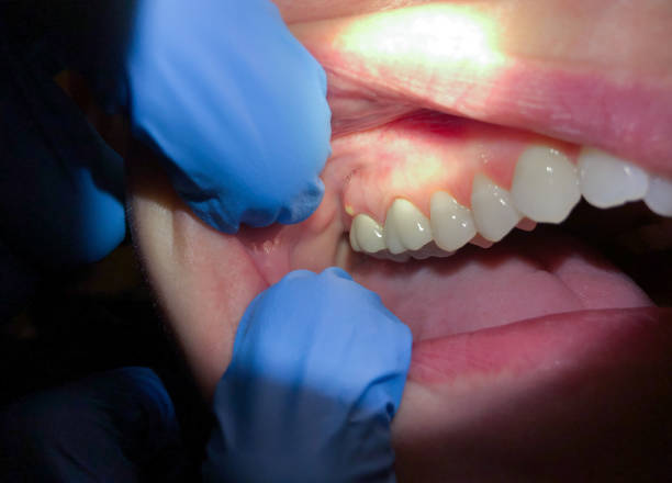 Best Emergency Dentist for Knocked-Out Tooth in Wamac, IL